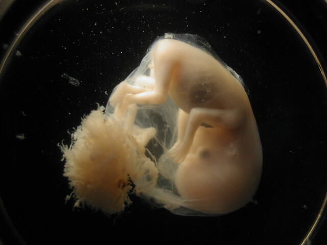 embryo