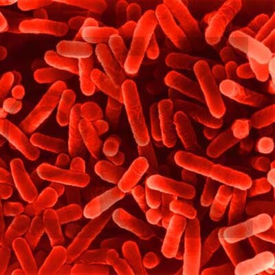 legionella