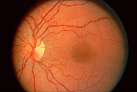 Noorderlicht - retina Noorderlicht - retina