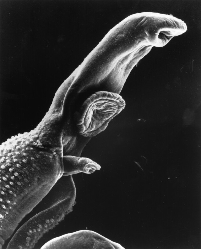 schistosoma schistosoma